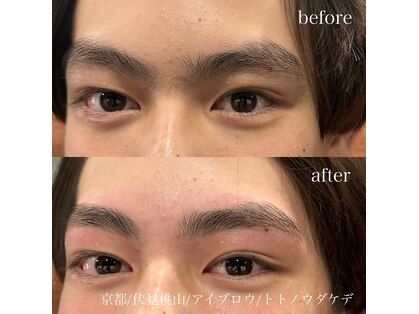 トトノウダケデ